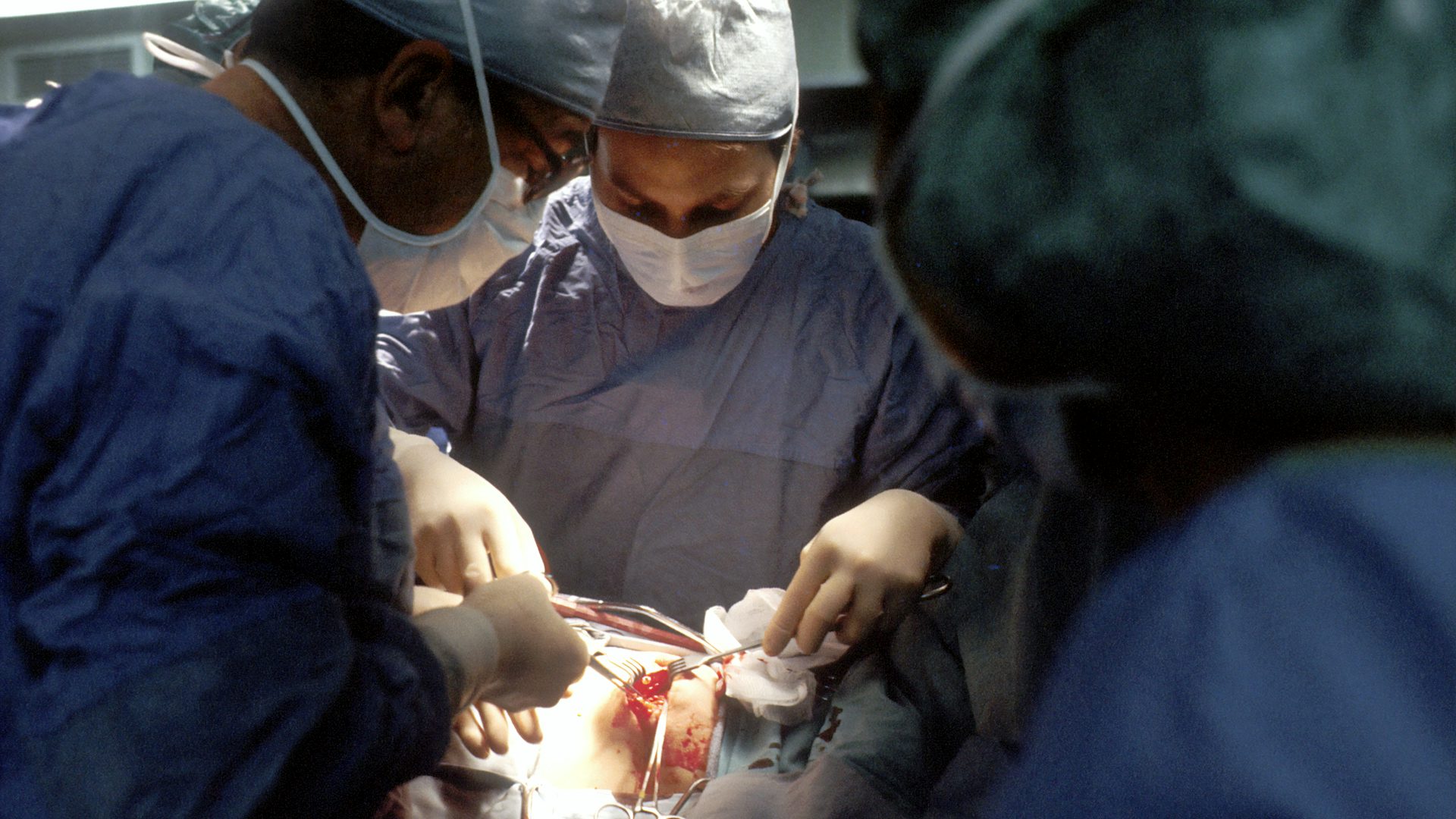 Cardiac surgery operation